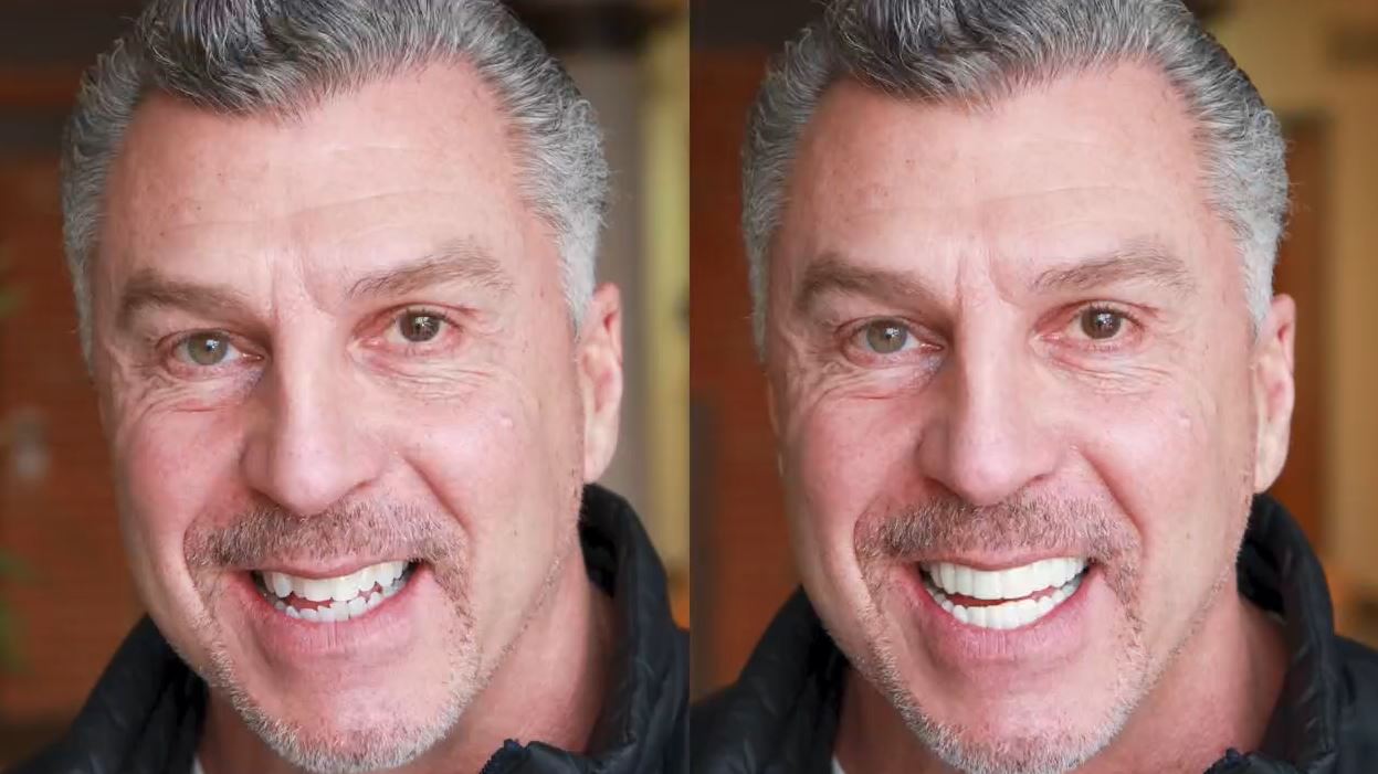 Man Wearing Shiny Smile Veneers