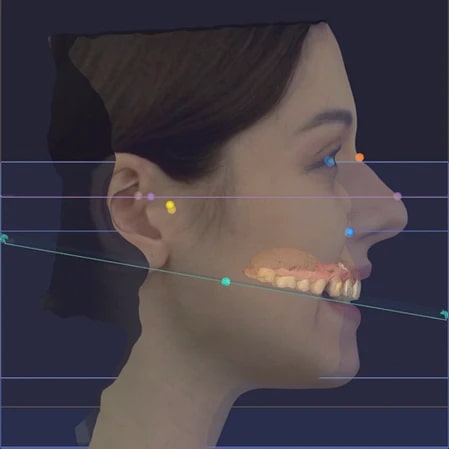 RayFace scans patients entire mouth and jaw